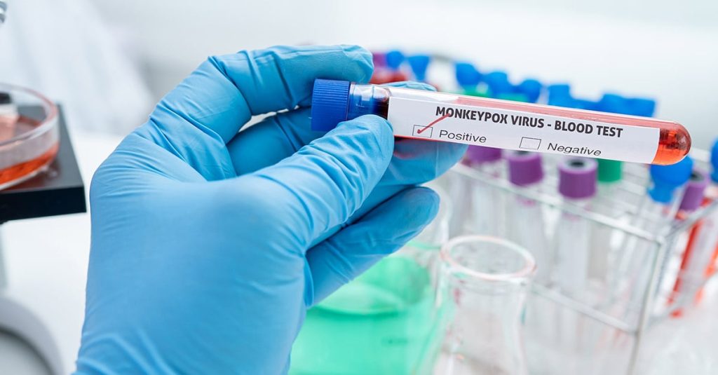 mokeypox Social 1200x627 3